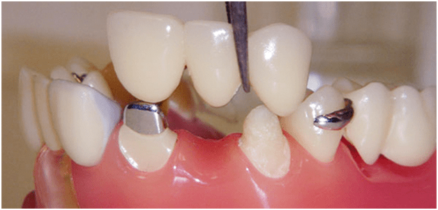 Prosthodontist